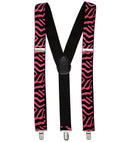 Pink Zebra Braces